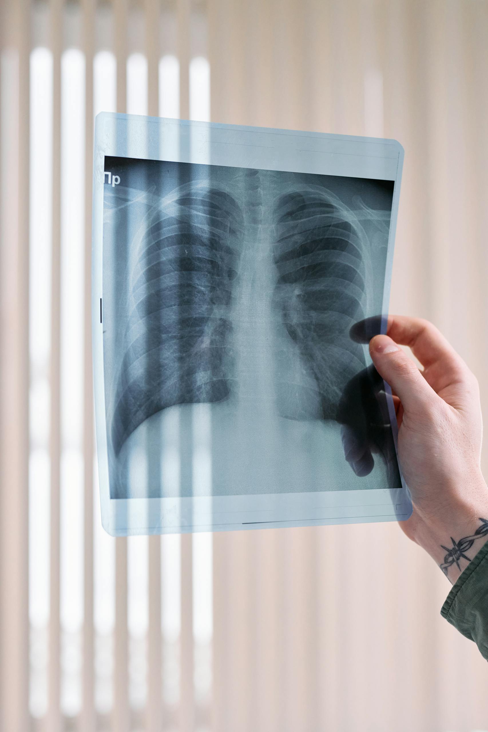A vertical shot of a doctor's hand holding a lung x-ray in a medical clinic, focusing on healthcare diagnosis.